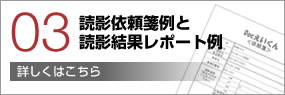 読影依頼箋例と読影結果レポート例